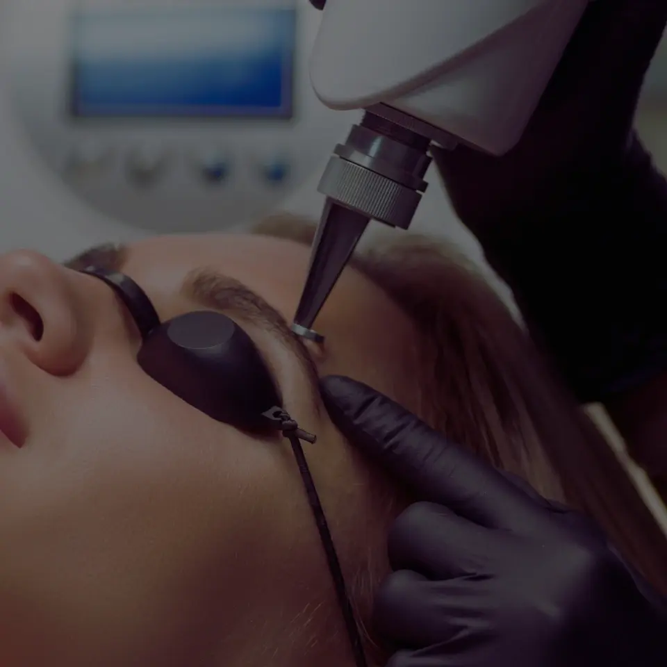 Laser Tattoo Removal vs Saline Removal: Which Works Best for PMU?
