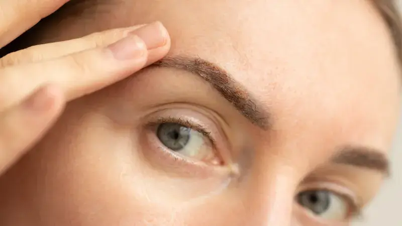 A woman with sparse or uneven brows from over-plucking or age